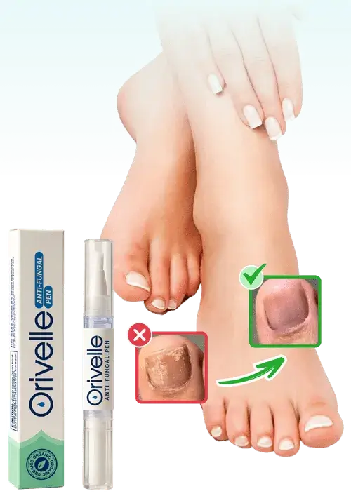 Orivelle Stift