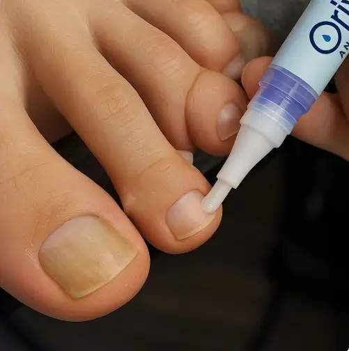Orivelle effektivitet
